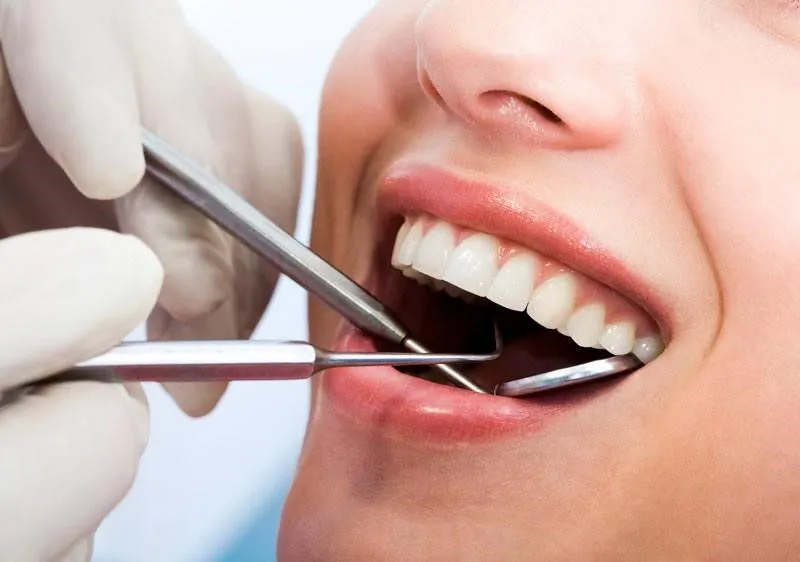 điều trị nha chu Hải Phòng