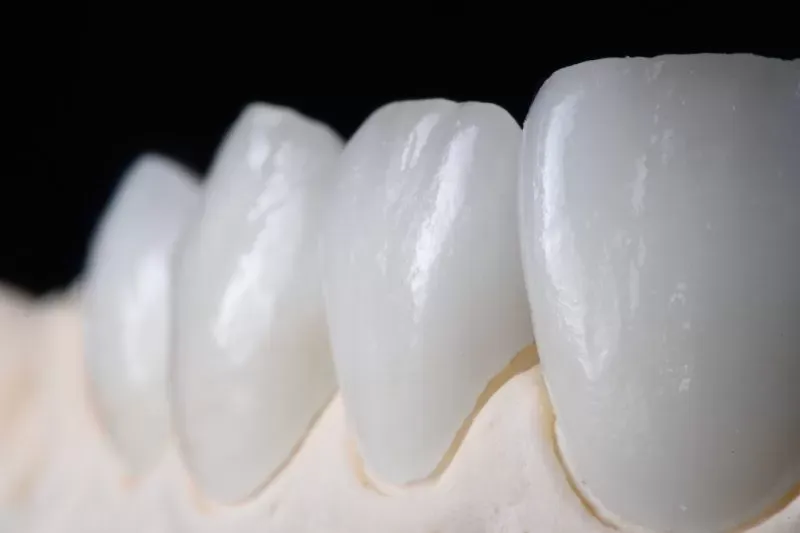 dan-su-veneer-hai-phong-1
