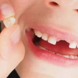 Dấu Hiệu Nhận Biết Trẻ Đang Thay Răng