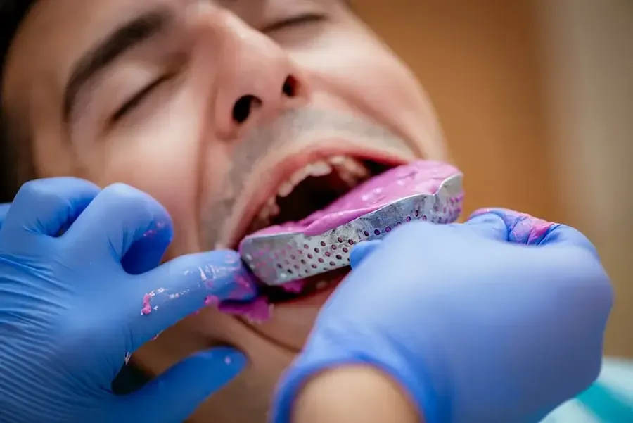 lấy dấu răng có đau không