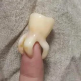 Răng khôn có mấy chân